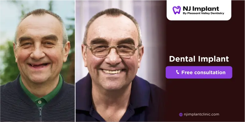 Why no dairy after dental implants