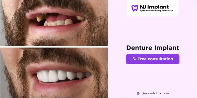 Cost of dentures